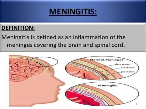 spinal meningitis definition